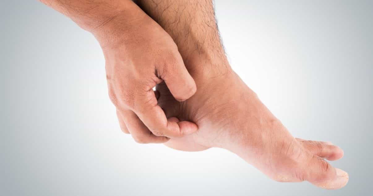 itch is one of many athletes foot symptoms